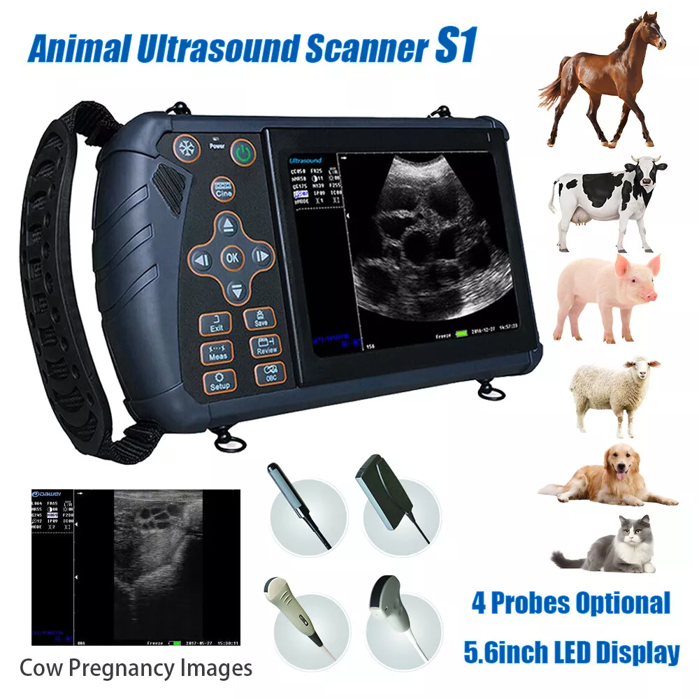 Tragbarer Ultraschall-Schwangerschaftstester Panasonic B erkennt den Zustand und die Gesundheit des Fötus.